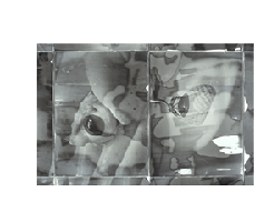 meaning radial keratotomy art photoemulsion video